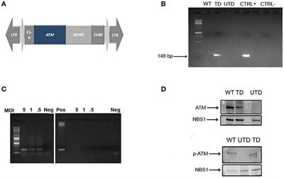 Reconstitution of the Ataxia-Telangiectasia Cellular Phenotype With Lentiviral Vectors